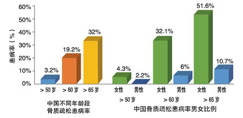 女性骨質(zhì)數(shù)據(jù)